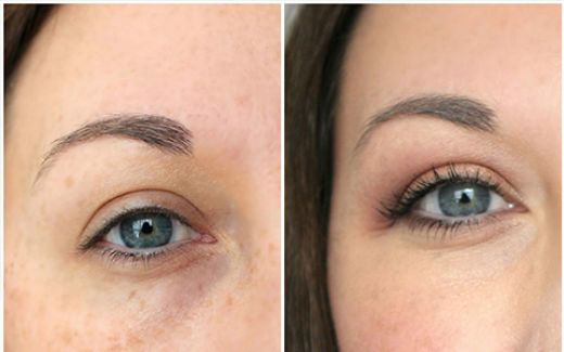 Somon DNA Aşısı Nasıl Uygulanır?